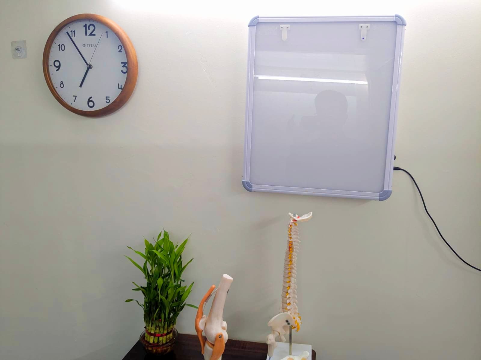 Anatomical spine and joint model used for patient education in Wakad clinic